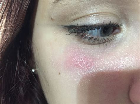 allergic to chanel makeup